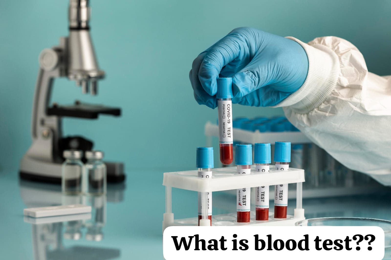 WHAT IS BLOOD TEST????ब्लड टेस्ट क्या होते हैं?