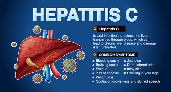 Hepatitis c virus ?? हेपेटाइटिस सी वायरस: लक्षण, निदान और उपचार