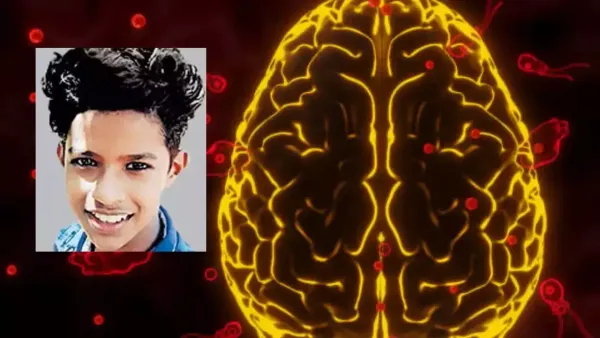 Brain Eating Amoeba:आगया हैं दिमाग को खाने वाला अमीबा ?केरला में हुई १२ की मौत?(brain eating amoeba in hindi)